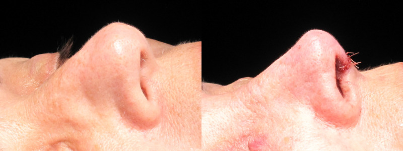 Patient 28 Combined Image