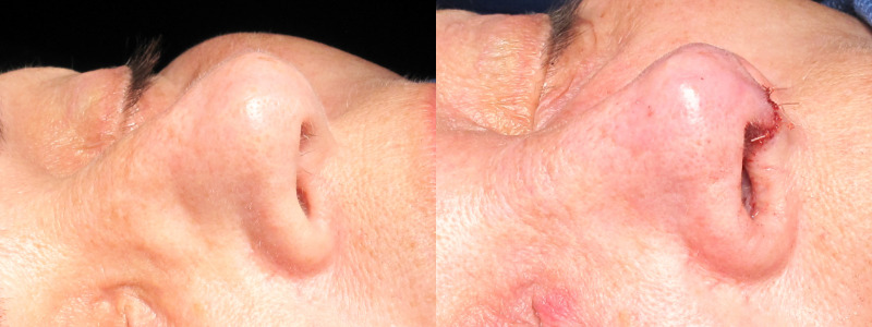 Patient 28 Combined Image