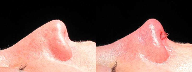 Patient 9 Combined Image