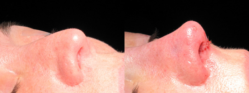 Patient 9 Combined Image