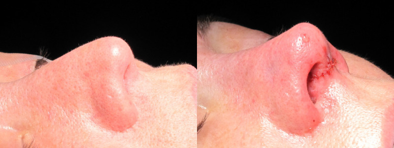 Patient 9 Combined Image