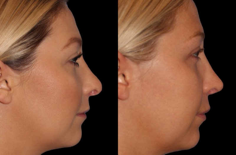 Patient 12 Combined Image