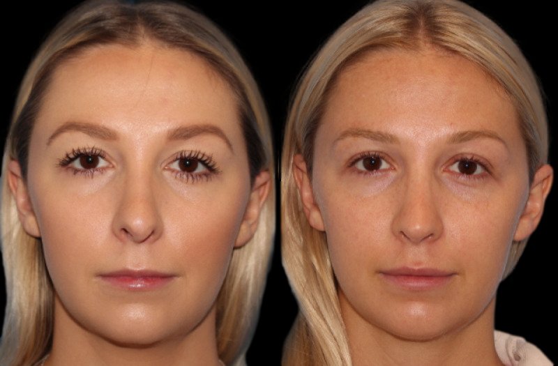 Patient 12 Combined Image