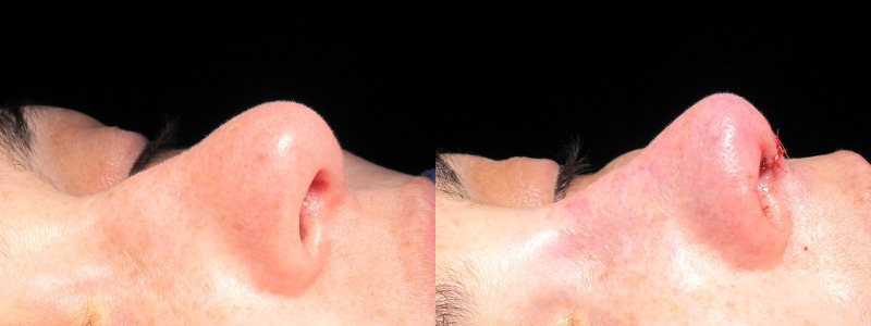 Patient 11 Combined Image