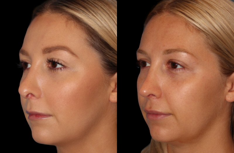 Patient 12 Combined Image