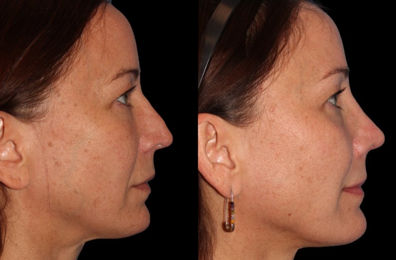 Patient 25 Combined Image