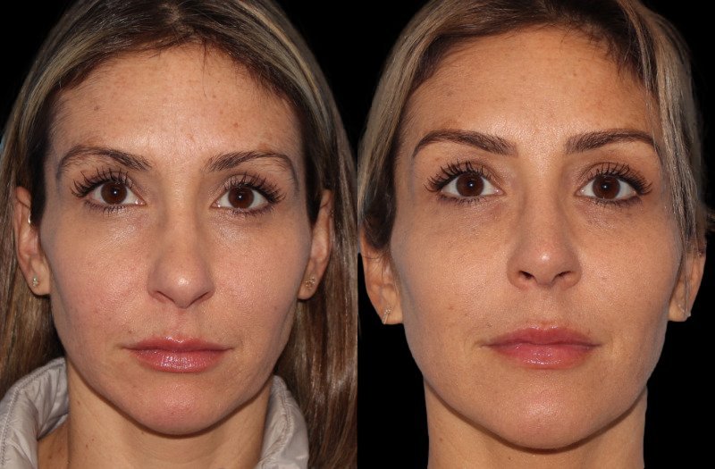 Patient 26 Combined Image