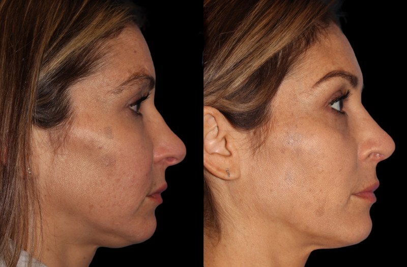 Patient 26 Combined Image