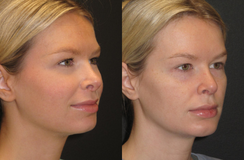 Patient 55 Combined Image