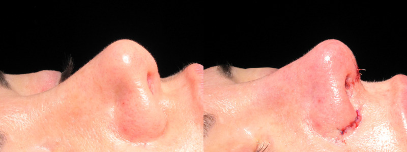 Patient 12 Combined Image