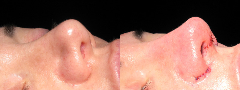 Patient 12 Combined Image