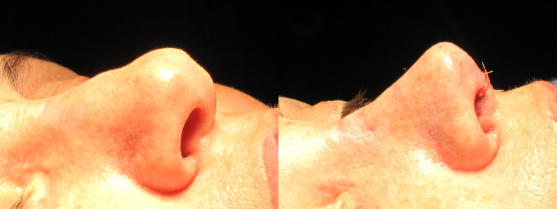 Patient 21 Combined Image