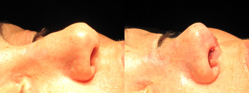 Patient 21 Combined Image