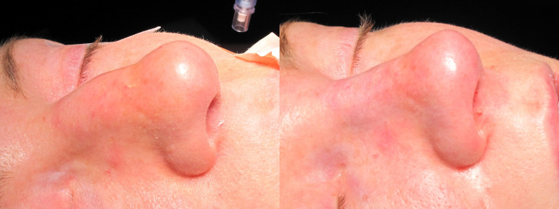 Patient 1 Combined Image