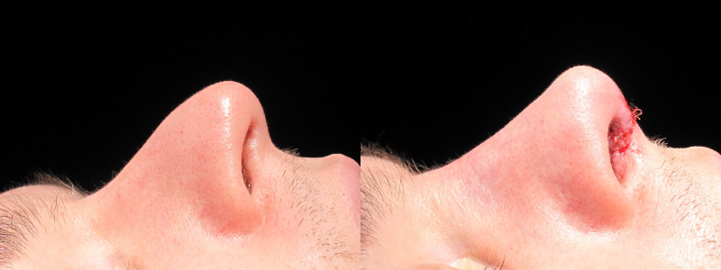 Patient 15 Combined Image