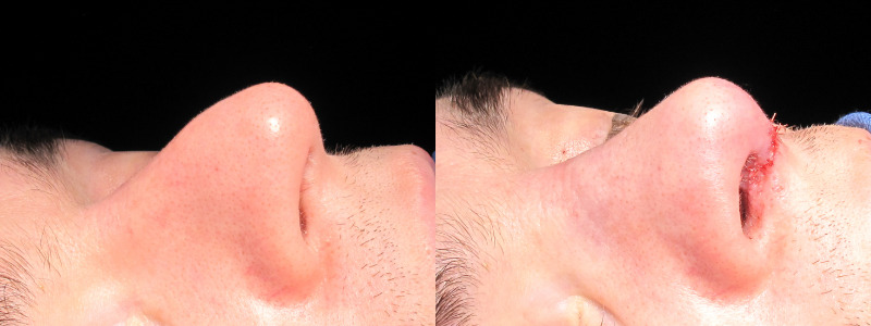 Patient 15 Combined Image