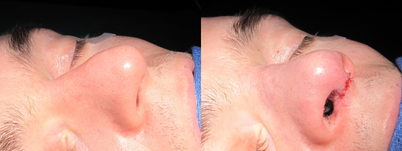 Patient 15 Combined Image