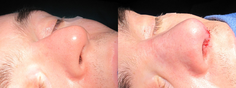 Patient 15 Combined Image