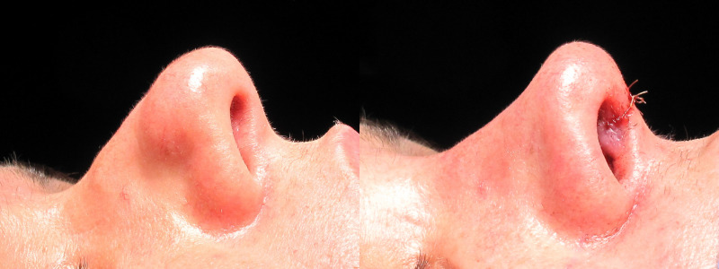 Patient 2 Combined Image