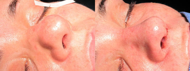 Patient 2 Combined Image