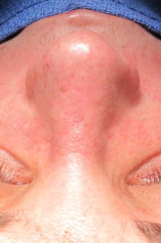 Patient 2 Combined Image