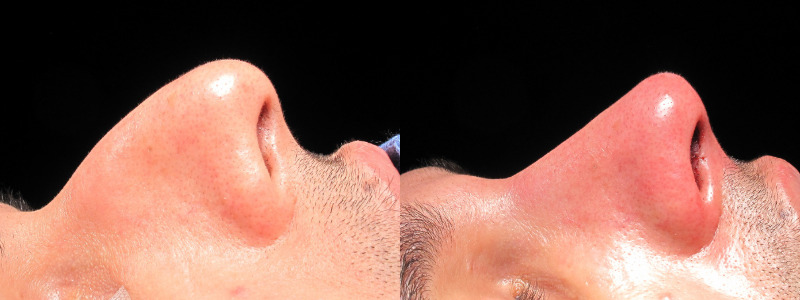 Patient 3 Combined Image