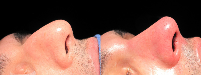 Patient 3 Combined Image