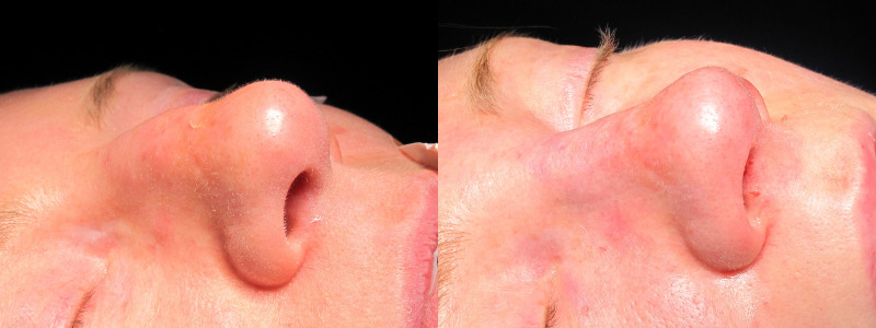 Patient 1 Combined Image