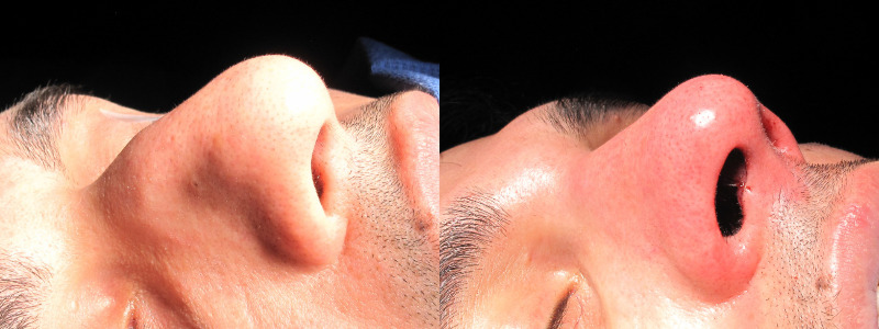 Patient 3 Combined Image