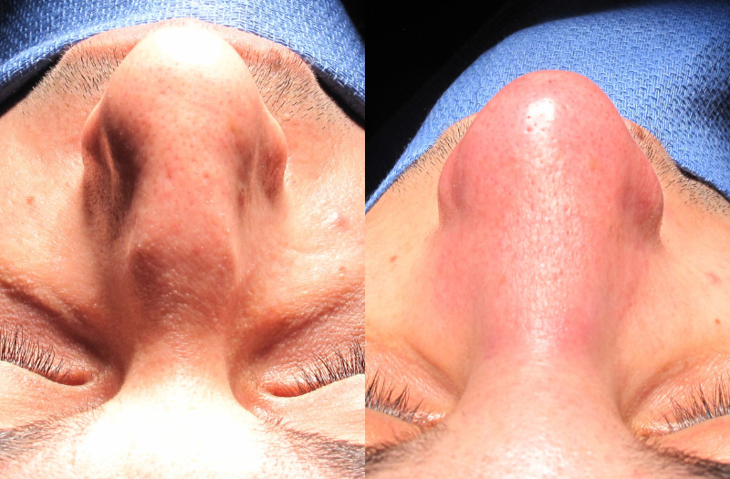 Patient 3 Combined Image