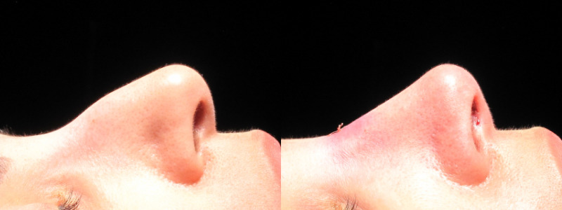 Patient 32 Combined Image