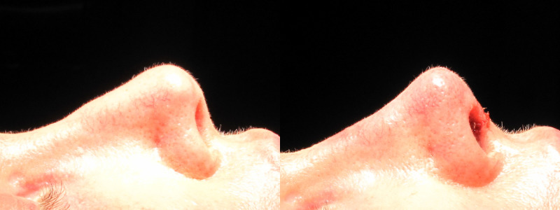 Patient 33 Combined Image