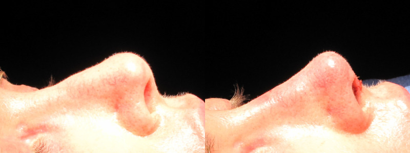 Patient 33 Combined Image