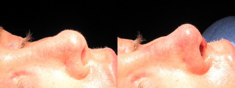 Patient 33 Combined Image
