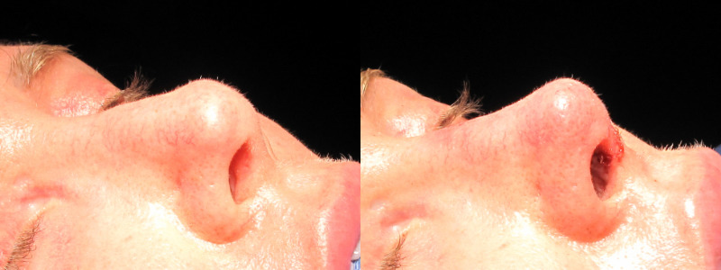Patient 33 Combined Image