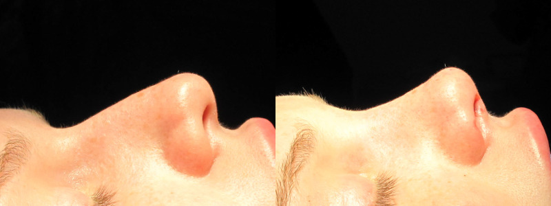 Patient 34 Combined Image