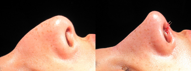 Patient 10 Combined Image