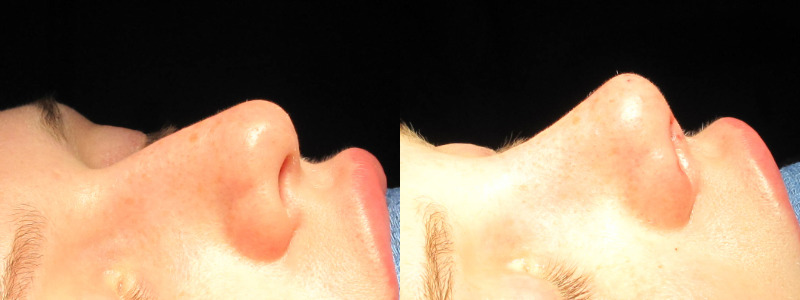 Patient 34 Combined Image