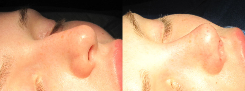 Patient 34 Combined Image