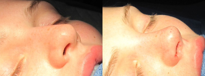 Patient 34 Combined Image