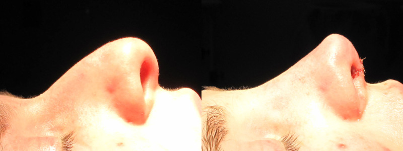 Patient 35 Combined Image