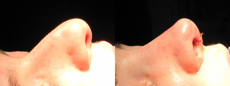 Patient 35 Combined Image