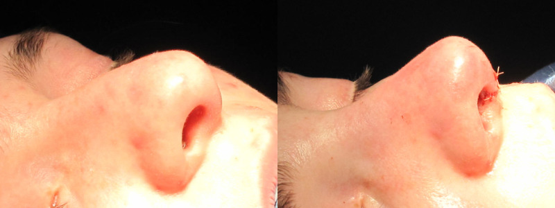 Patient 35 Combined Image