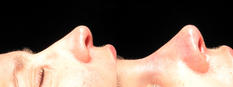 Patient 36 Combined Image