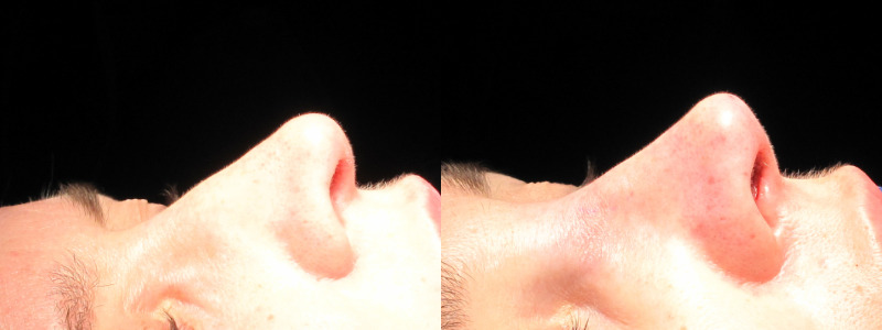 Patient 36 Combined Image