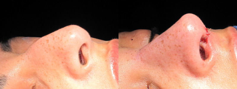 Patient 10 Combined Image