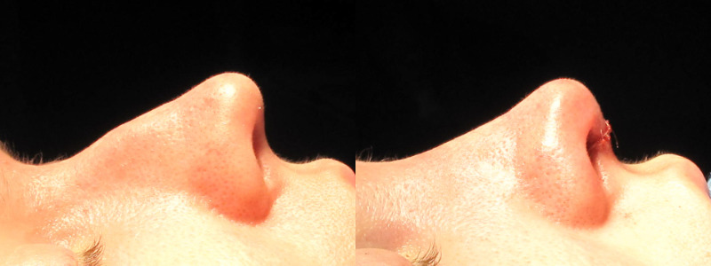 Patient 37 Combined Image