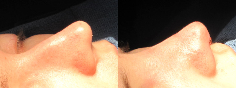 Patient 37 Combined Image