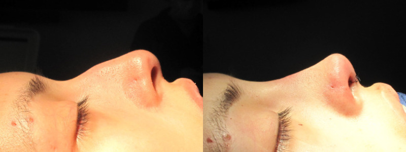 Patient 38 Combined Image