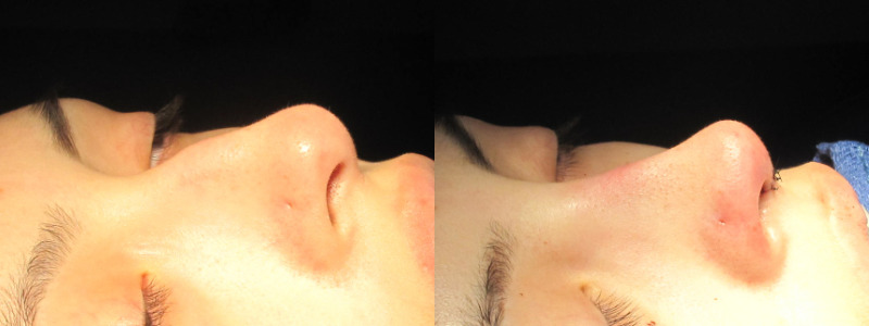 Patient 38 Combined Image